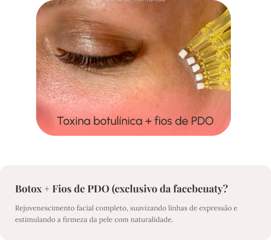 botox